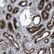 NBP1-87316 - CDK17 / PCTK2