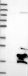 NBP1-86378 - PFDN2