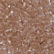 NBP1-81995 - PGBD4