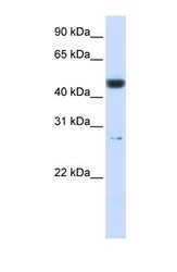 NBP1-56387 - PGLS / 6PGL