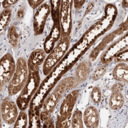NBP1-87274 - TP53I3