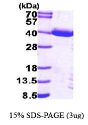 NBP1-44458 - TP53I3