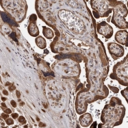 NBP1-83142 - PMVK