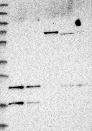 NBP1-83142 - PMVK