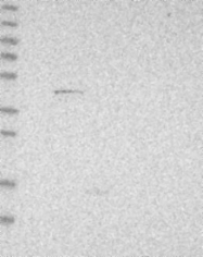 NBP1-83227 - POLG2 / MTPOLB