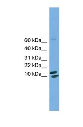 NBP1-55448 - Cyclophilin H / PPIH