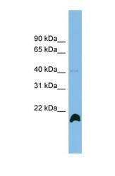 NBP1-57630 - Cyclophilin H / PPIH