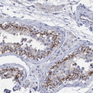 NBP1-86656 - PPP3CC / CALNA3