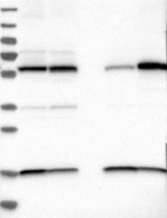 NBP1-86656 - PPP3CC / CALNA3