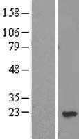 NBL1-14708 - PPP3R2 Lysate