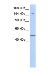 NBP1-52842 - PRDM15