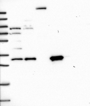NBP1-92286 - AMPK beta-2 chain / PRKAB2