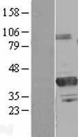 NBL1-14796 - PRMT6 Lysate