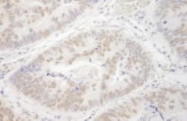 NBP1-41112 - PRMT6 / HRMT1L6