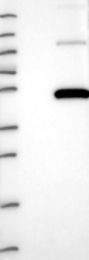 NBP1-81702 - PRMT8 / HRMT1L3
