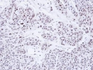 NBP1-33117 - PRPF19 / NMP200