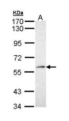 NBP1-33117 - PRPF19 / NMP200