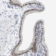 NBP1-89919 - TP53RK