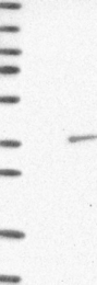 NBP1-89919 - TP53RK