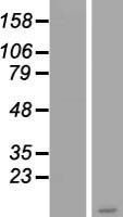 NBL1-14856 - PSCA Lysate