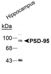 NB300-294 - DLG4 / PSD95