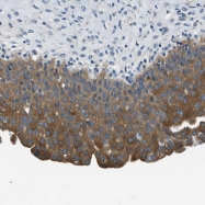 NBP1-90297 - Twinfilin-1 (TWF1)