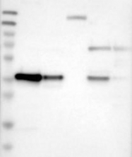 NBP1-90297 - Twinfilin-1 (TWF1)
