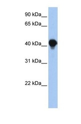 NBP1-59028 - PTPLAD1 / BIND1