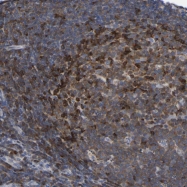 NBP1-81756 - PTPN7 / HEPTP