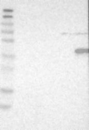 NBP1-81756 - PTPN7 / HEPTP