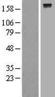 NBL1-14985 - PTPRJ Lysate