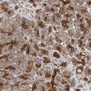 NBP1-86554 - CD111 / Nectin 1