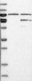 NBP1-87960 - ETV4 / PEA3