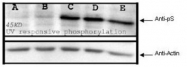 NBP1-78034 - RPS6KA1