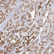 NBP1-90098 - RCHY1 / PIRH2