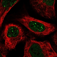 NBP1-89781 - Glycodelin / PAEP