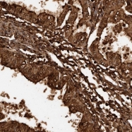 NBP1-89781 - Glycodelin / PAEP
