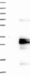 NBP1-89781 - Glycodelin / PAEP