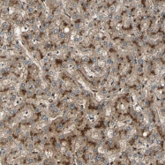 NBP1-87711 - KLKB1 / Kininogen