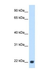 NBP1-58978 - KLKB1 / Kininogen