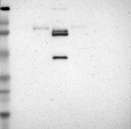 NBP1-87711 - KLKB1 / Kininogen