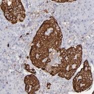 NBP1-89649 - Transthyretin / Prealbumin