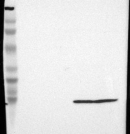 NBP1-89649 - Transthyretin / Prealbumin