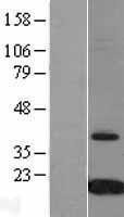 NBL1-17423 - Prealbumin Lysate