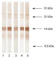 NB110-13042 - Procalcitonin
