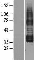 NBL1-14939 - Prostaglandin I2 Receptor Lysate