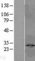 NBL1-14682 - Protein phosphatase 1 inhibitor subunit 2 Lysate