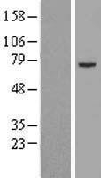 NBL1-09906 - Pyruvate Dehydrogenase E2 Lysate