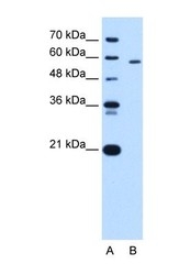 NBP1-56319 - PKLR