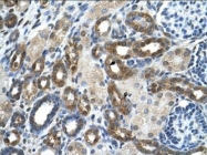 NBP1-56319 - PKLR